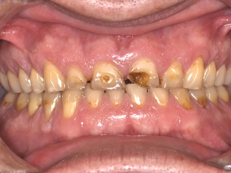 case 043 retracted before photo