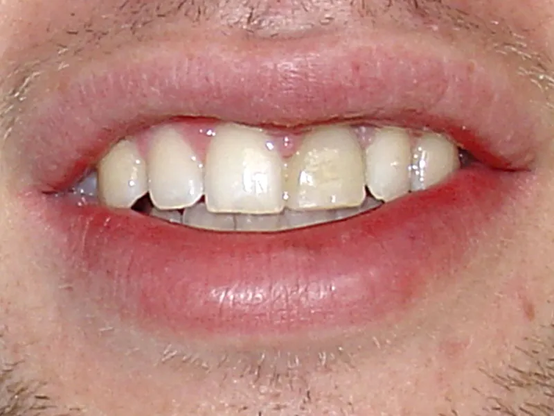 case 046 smile before photo