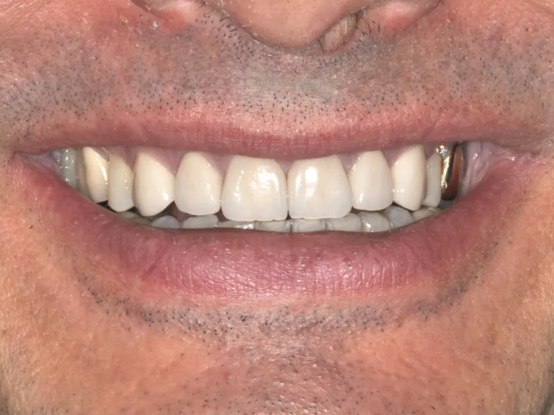 case 047 smile after photo