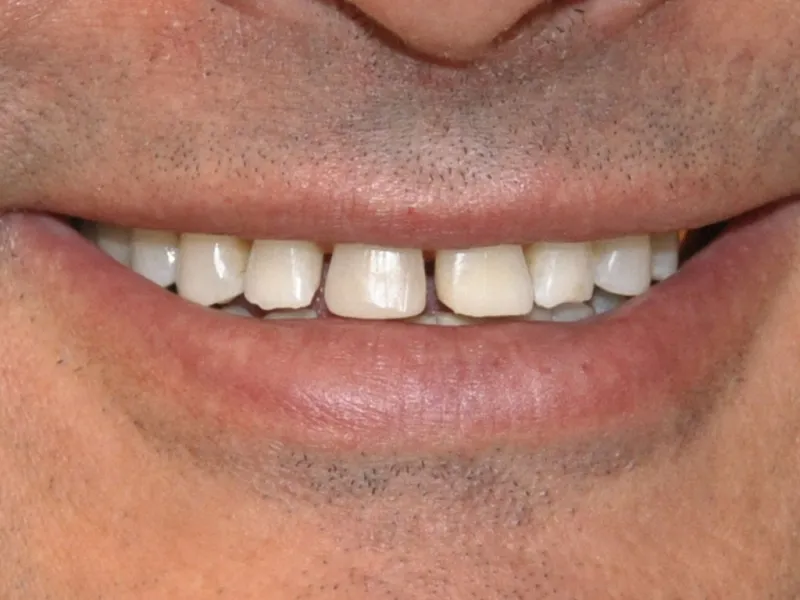 case 047 smile before photo