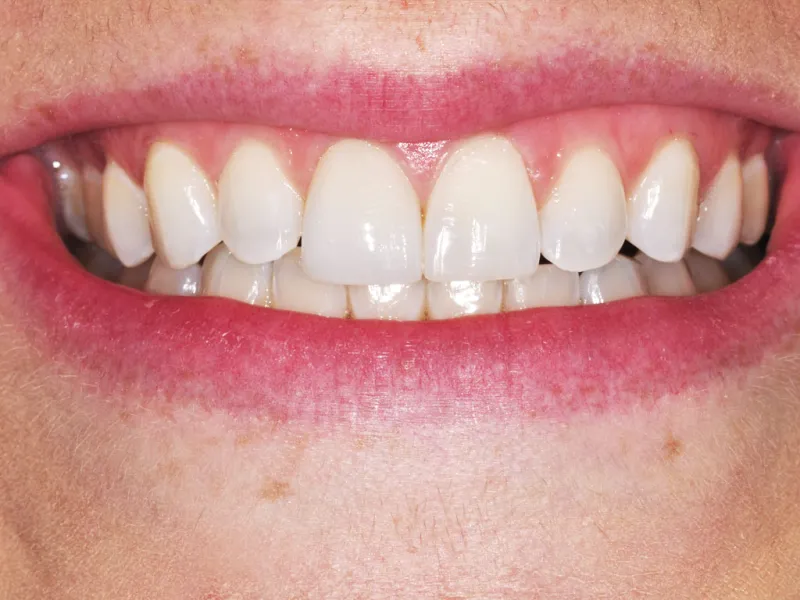 case 048 smile after photo