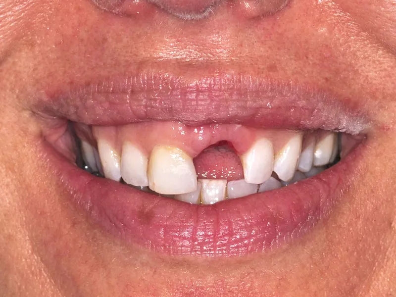 case 049 smile before photo