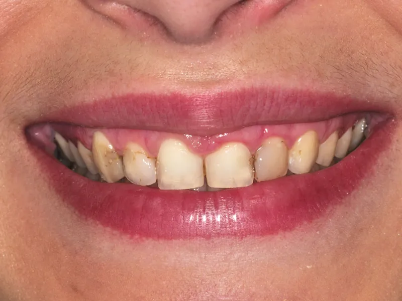 case 067 smile before photo