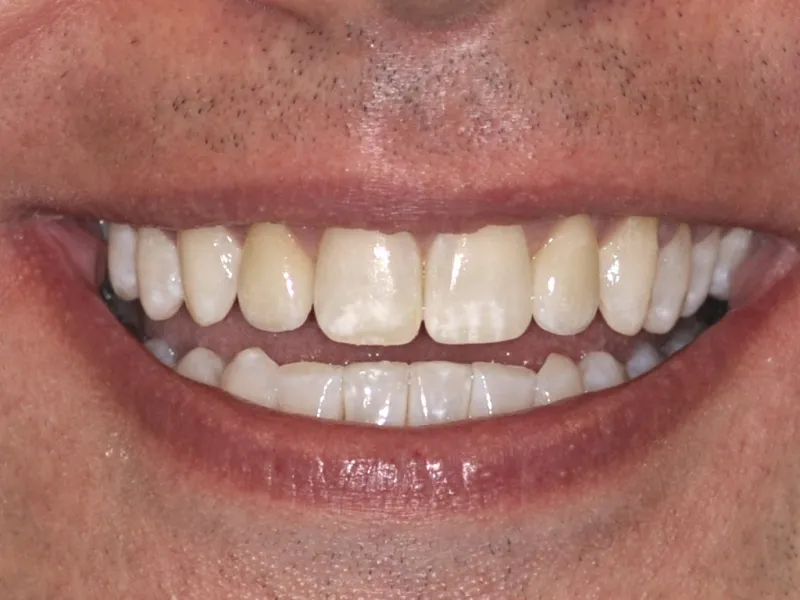 case 068 smile after photo 