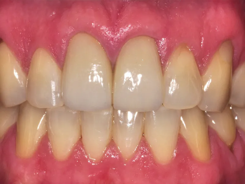 case 070 retracted after photo