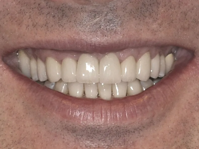 case 071 smile after photo