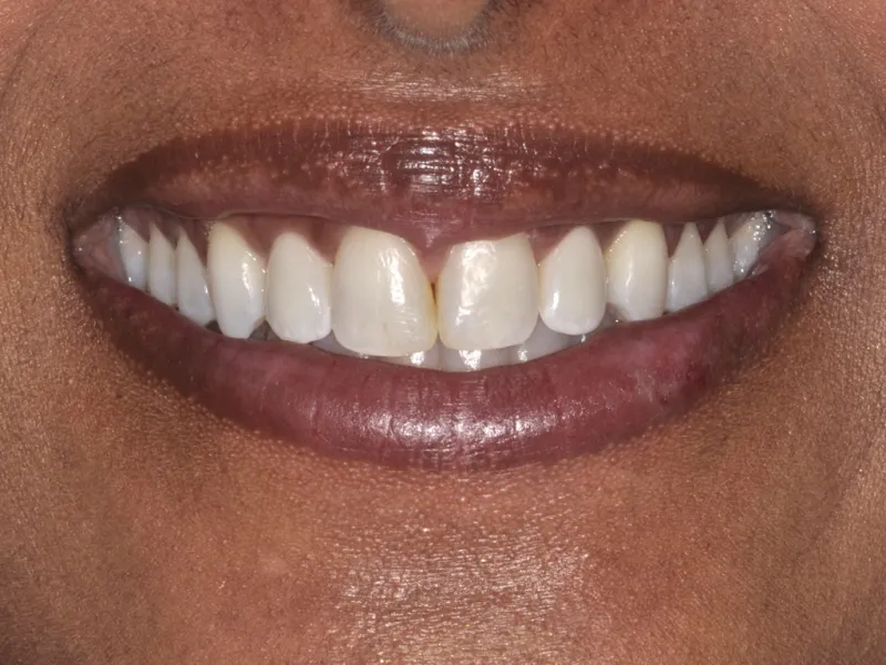 case 072 smile after photo