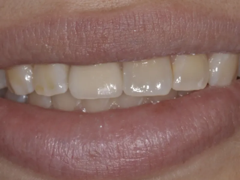 case 074 smile after photo