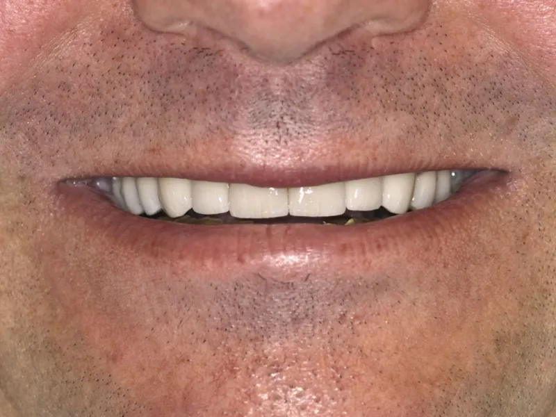 case 077 smile after photo