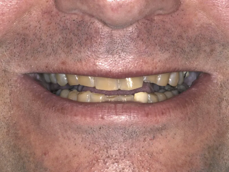 case 077 smile before photo