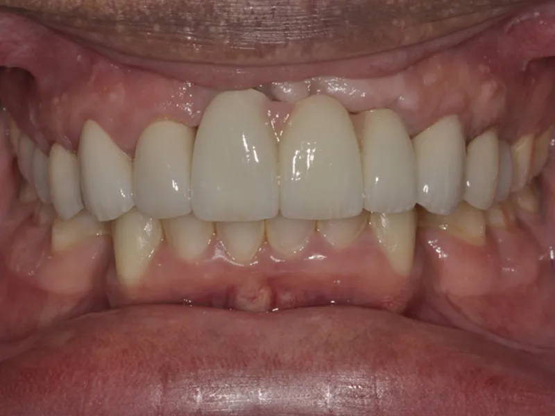 case 080 retracted after photo