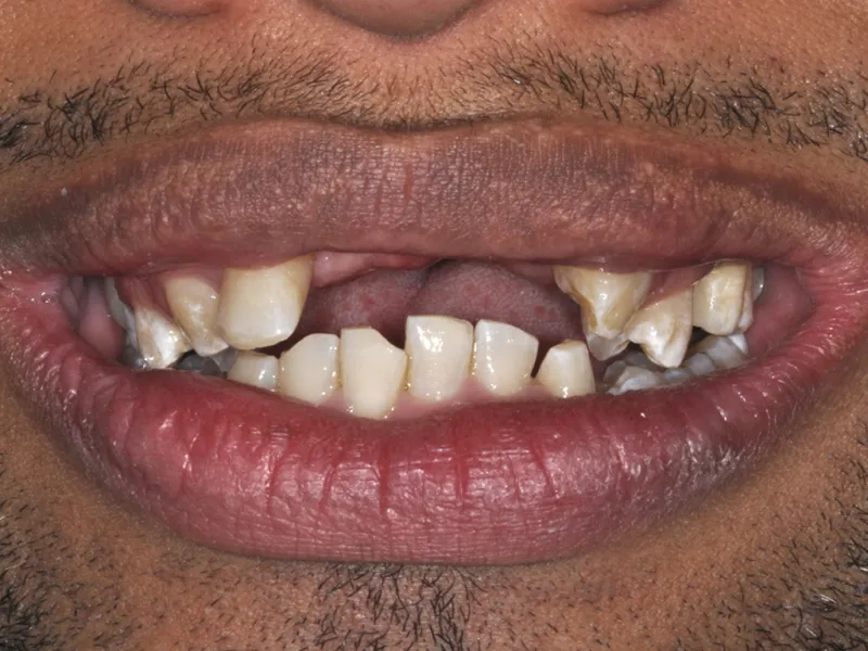 case 080 smile before photo