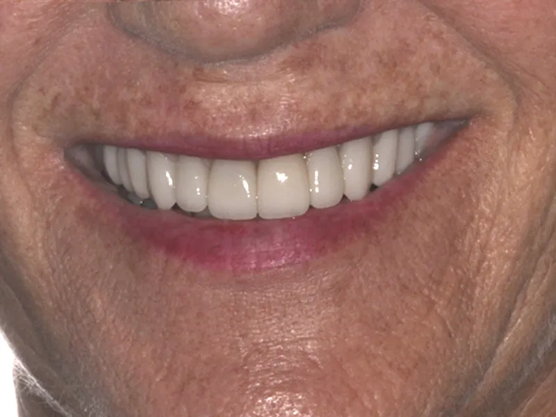 case 087 smile after photo