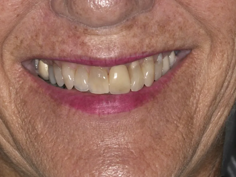 case 087 smile before photo