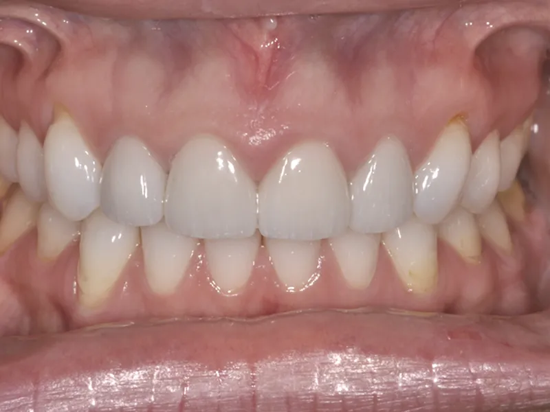 case 088 retracted after photo