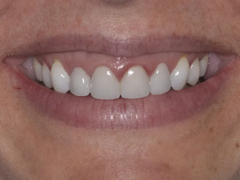 case 088 smile after photo