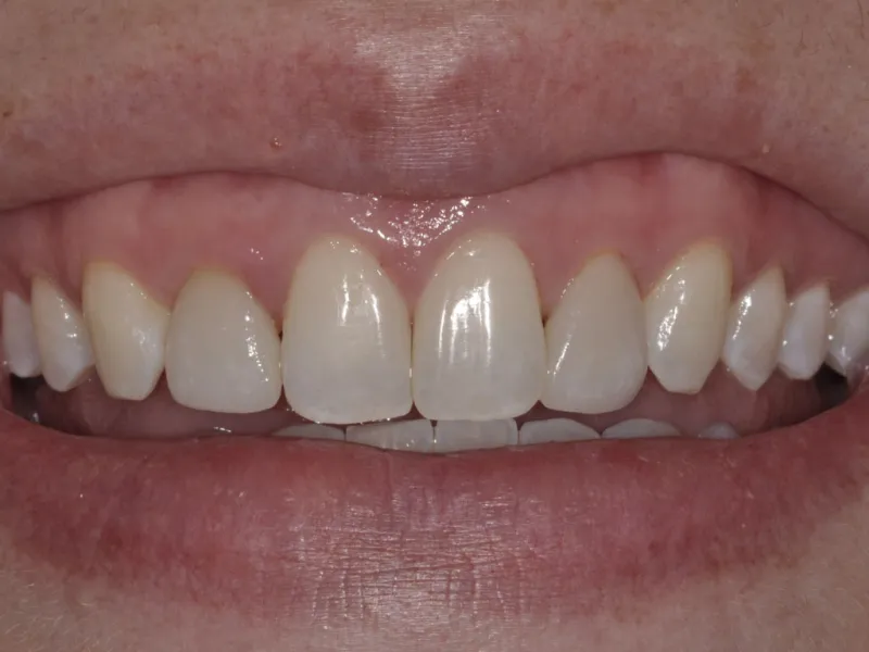 case 089 smile after photo