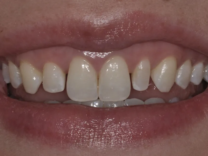 case 089 smile before photo