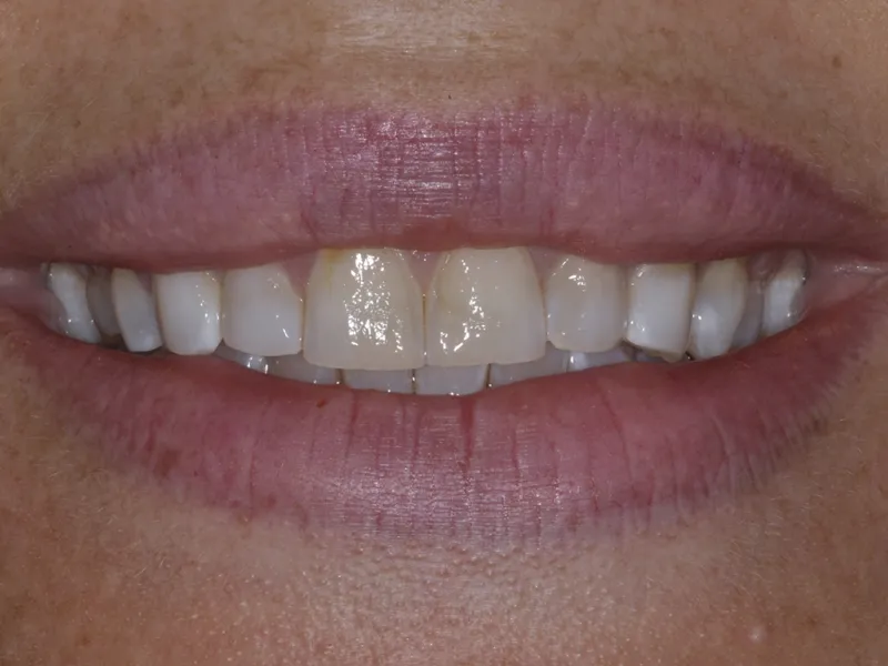 case 091 smile before photo