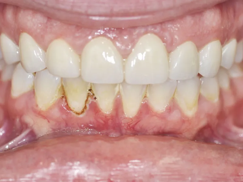 cases 300 retracted after photo