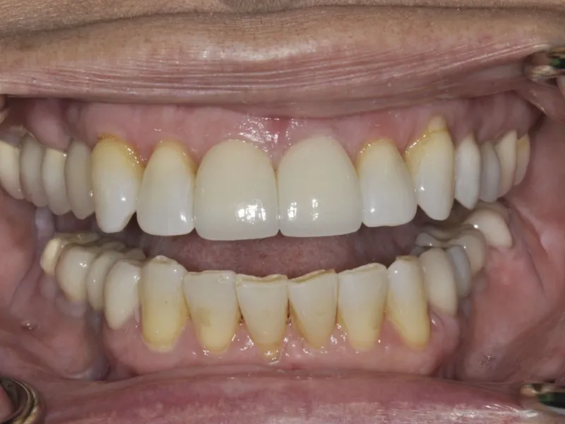 Case 303 retracted after photo