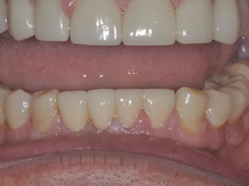 Case 306 retracted after photo