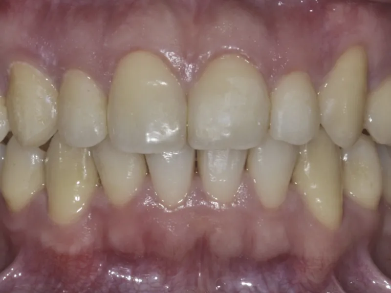 case 309 retracted after photo