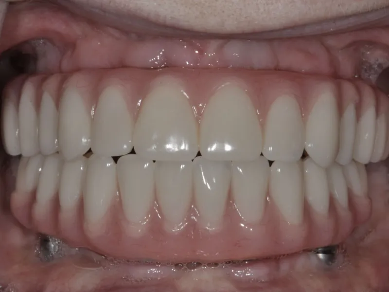 Case 310 retracted after photo