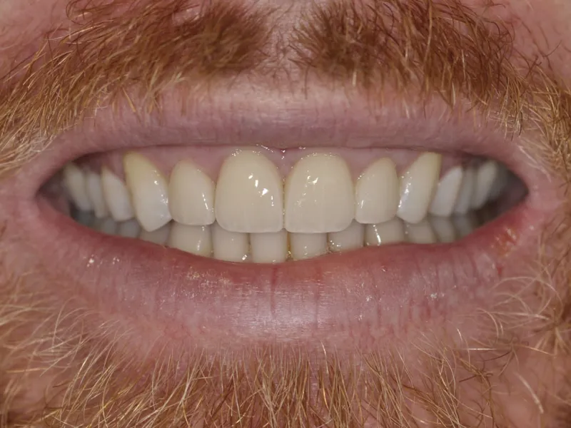 A photo of case 312 smiling after.