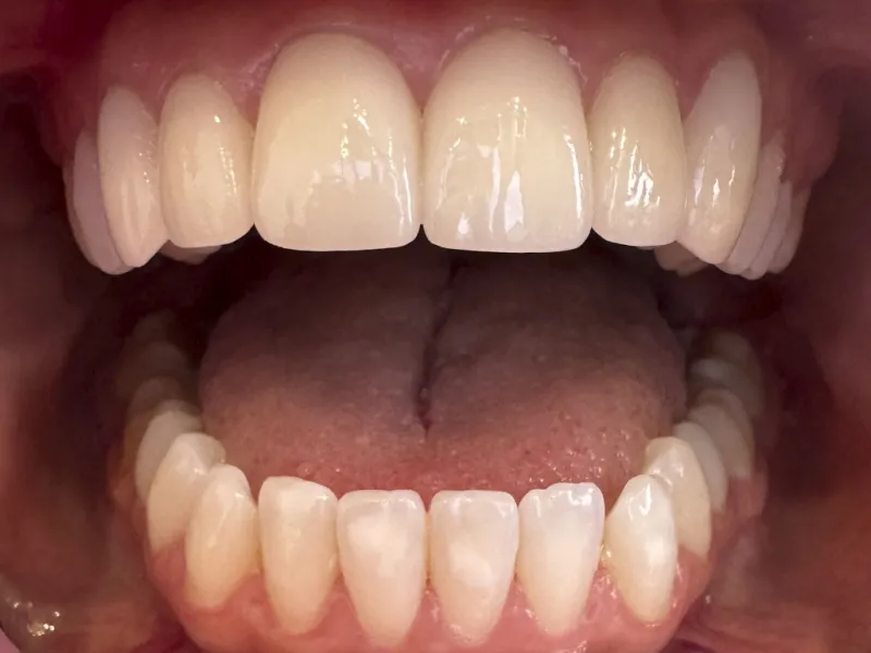 case 502 smile after photo