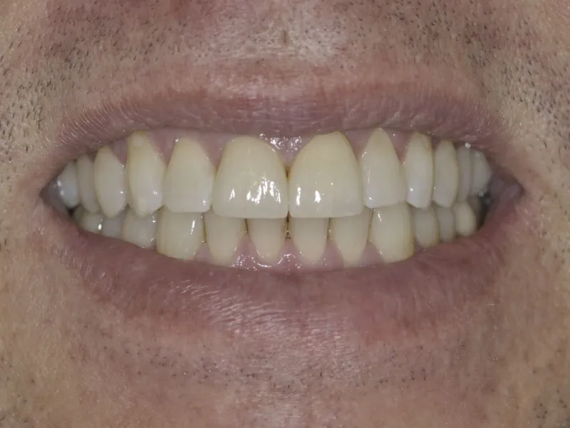 case 505 smile after photo