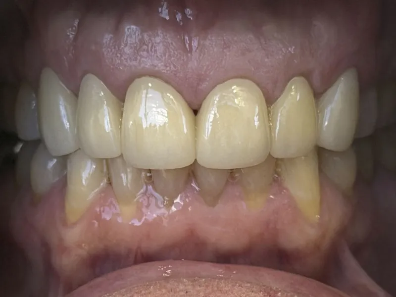 case 506 retracted after photo