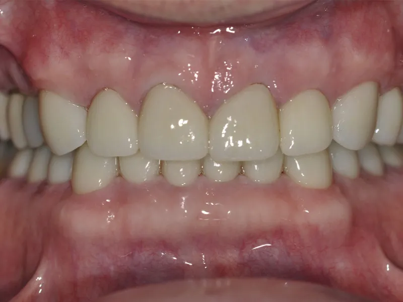case 507 retracted after photo