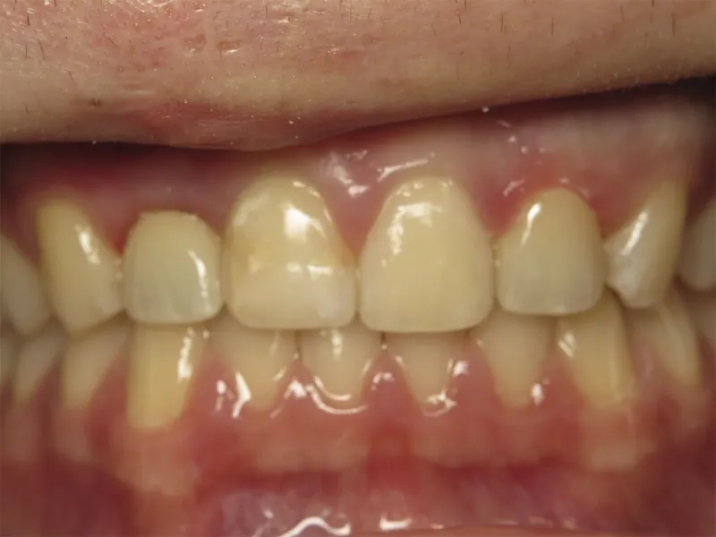 case 606 retracted after photo