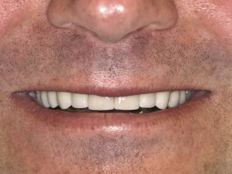 scotts smile photo
