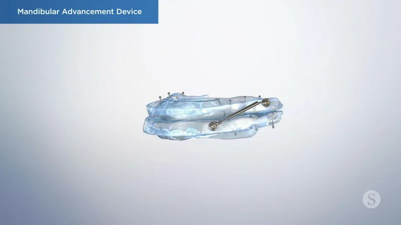 A video still - Sleep Appliance with an image showing an oral sleep appliance.